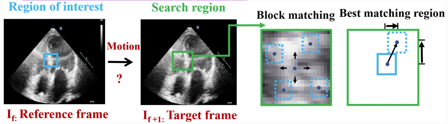 echocardiogram